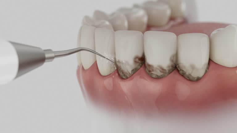 Reliable Dental Implants contractor in Taylor, MI by Smile Center Dentistry